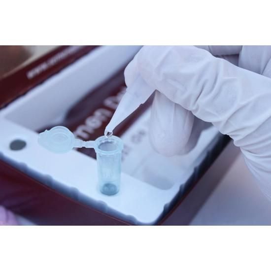 VERIFICA® SEMEN DETECTOR® TEST DE INFIDELIDAD